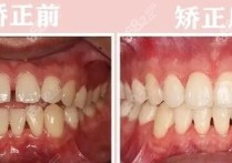 时代天使要反转了？